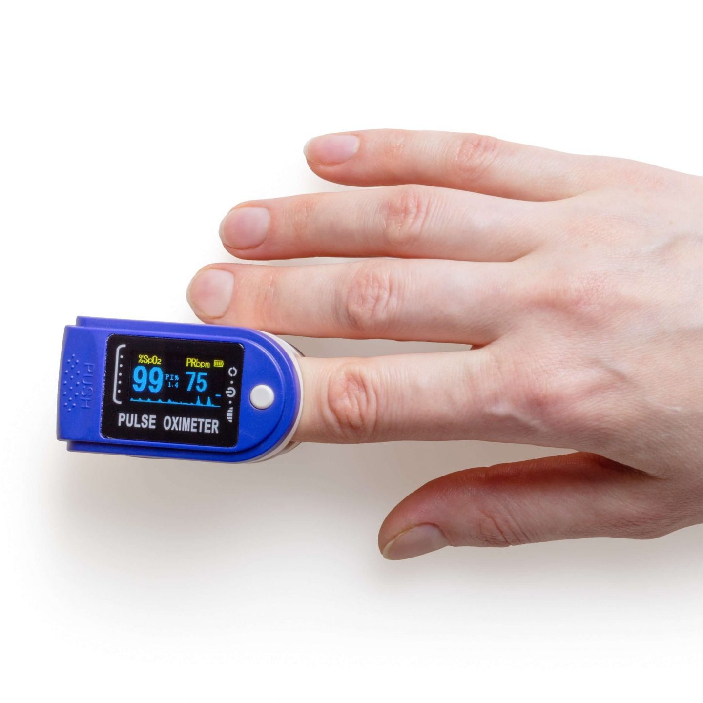 Tendencias de IoT 2021: más enfocado en lo fundamental